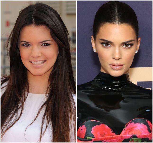 Kendall Jenner átalakulása