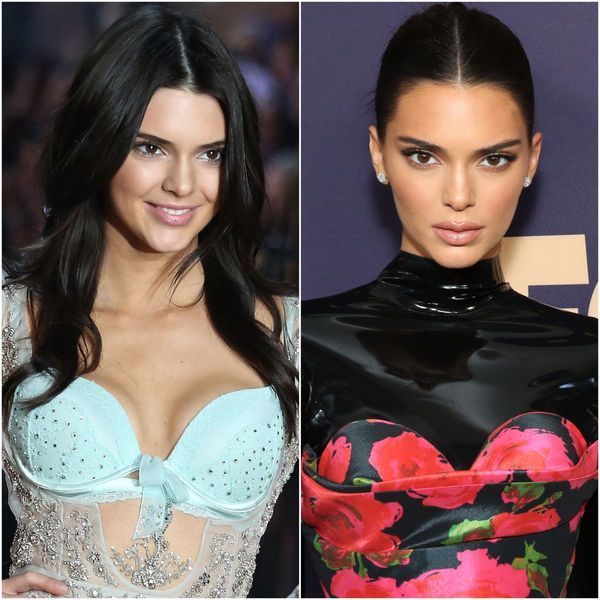 Kendall Jenner ha estat durant molt de temps el tema dels rumors de cirurgia plàstica, però s’ha anat sota el ganivet?