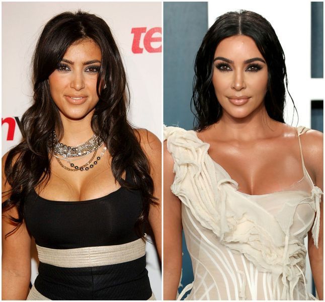 Transformació de la cirurgia plàstica de Kim Kardashian abans i després